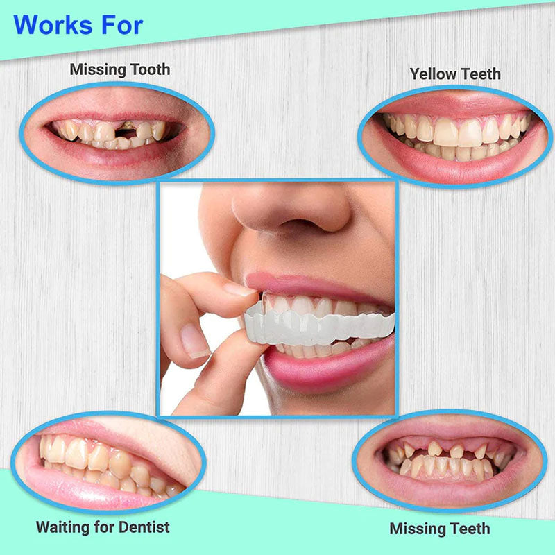 Snap On Smile Braces 😊